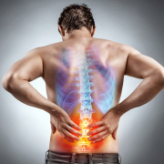 fratture vertebrali sintomi